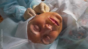 Aged woman doing mesothreads and Thread Lifting, Cosmetology. Cosmetic procedure to eliminate signs of aging. Beauty Face, Facial contour, plastic surgery concept for Age 70-80 years.