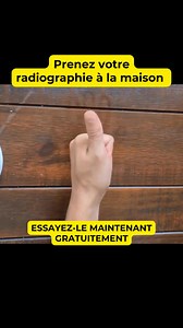 4K reactions · 231 shares | Radiographie numérique ! Application gratuite. | WorldPlus | Facebook
