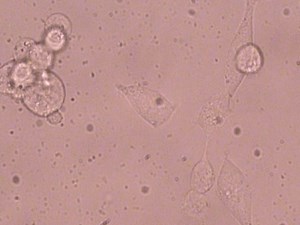 Whole-cell Patch-clamp Recordings for Electrophysiological Determination of Ion Selectivity in Channelrhodopsins