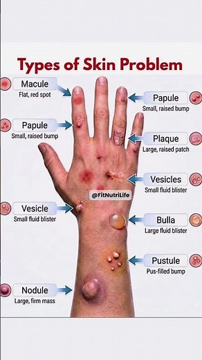 Types of Skin Problems Explained | Skin Lesions You Should Never Ignore #healthylifestyle