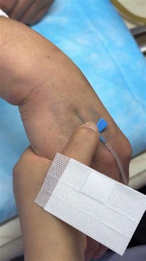 Injection Technique Made Simple | Types of Needle Injections You Need To Know 6