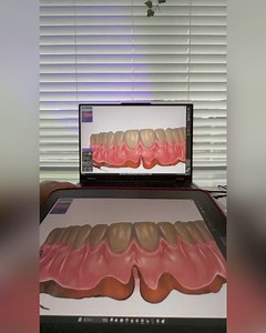 1.3K views · 27 reactions | Diseñando la anatomia gingival 醴  themodinstitute | Odontologos.com.co | Facebook