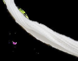 Artificial ligaments LIGASTIC® - Orthomed