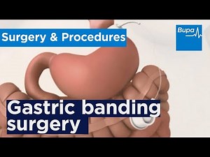 How gastric banding surgery is carried out | Bupa Health