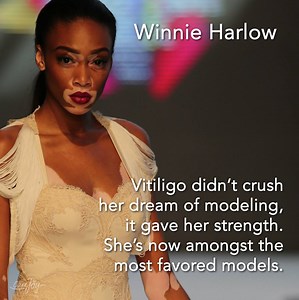 36K views · 607 reactions | These Models Revolutionized Traditional Beauty Standards | Curejoy Videos | Facebook