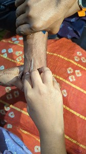 Perfect vein vibes 😍💉 So satisfying to see! #VeinGoals #CannulationLife #NurseLife #MedicalVibes #SatisfyingView | Mobassera Akanda