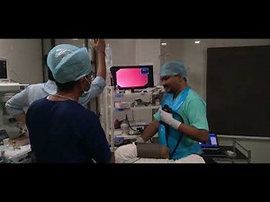 ENDOSCOPIC VARICEAL BAND LIGATION.