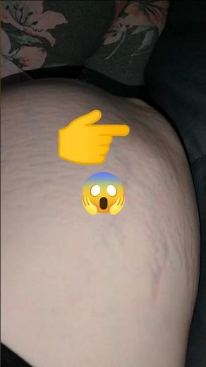 Baby trying to get out! 😱 36 Weeks Pregnant, baby kicking in belly, amazing pregnancy movements