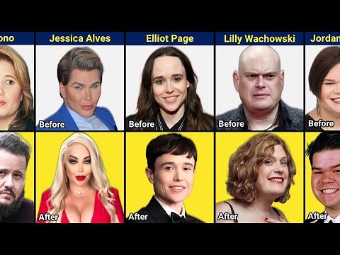 35 Celebrities Who Underwent Gender Transition - Before and After
