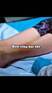 945K views · 6.7K reactions | A 14y/o girl his the boon denstiy an 80y woman #fyp #fbreels #fly | movie clip world | Facebook