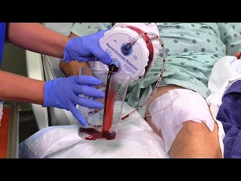 Wound Drainage: Everything You Should Know