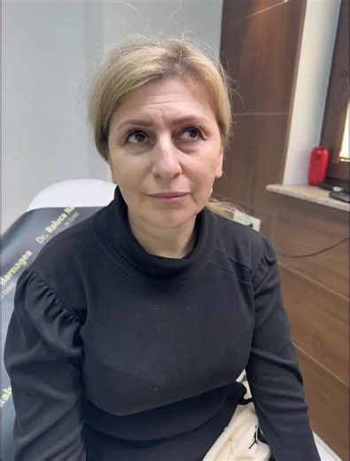 Tratament personalizat pentru un look mai fresh, mai putine riduri, iar declaratia pacientei de 100 puncte “Nici nu trebuie sa mai folosesc faceapp”🤩 #drralucaharnagea #skincare #filler #glowingskin #facialtreatment #doctor #dermatolofy | Dr. Raluca Harnagea