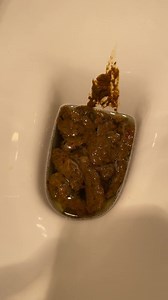 Urgent diarrhea explosion at the office