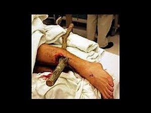 Medical Trauma Level One Trauma Hospital Hewlett Documenatry & Discovery HD Channel ™