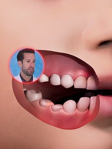Doctor Reacts to Boy's Jaw Tumor Grew Over 500 Teeth (Zack D. Films) | Doctor Reacts