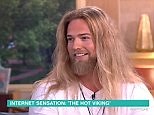 Hot Thor lookalike got bullied for having bugs bunny teeth