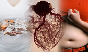 Advert warns to act FAST when you see signs of a stroke