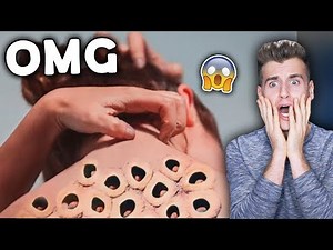The Ultimate Trypophobia Test (Good Luck)