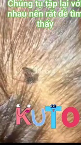 16K views · 2.1K reactions | LICE TREATMENT, ASMR ️✅ #treatmentkuto #lice #vietnam #fblifestyle | Srie Yontha | Facebook