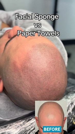 5.5K views · 24 reactions | Using facial sponges for hair tattooing helps keep the work area cleaner. Paper towels tend to shed fibers and break apart from remaining hair follicles, creating more cleanup. A single facial sponge can replace multiple paper towels, reducing waste and mess. #HairTattooing #HairTattooCleanup #FacialSponges #EfficientWorkstations #TattooPrep #CleanWorkArea #ZeroWaste | Victor Villarreal | Facebook