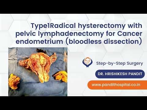 Type1Radical hysterectomy with pelvic lymphadenectomy for Cancer endometrium (bloodless dissection)
