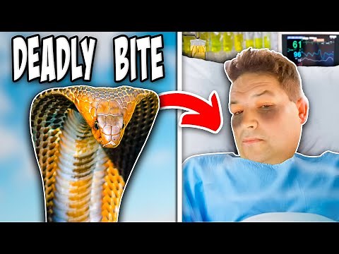 Man Almost Dies From Venomous Snake Bite! His Story!