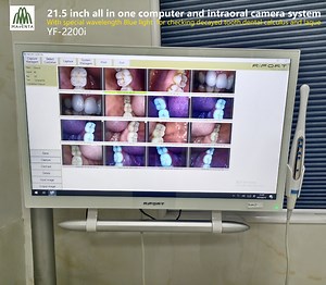 [Hot Item] Dental Touch Screen Computer and HD Blue Light Intraoral Camera Unit for Checking Decayed Tooth/Calculus and Plaque