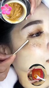 1.6M views · 7.7K reactions | A secret wrinkle and pigmentation removal mixture that no one told you about #pigmentation #darkspots #spotlessskin #skincare #fbreelsfypシ゚ #reelsvideo #fbreels2025ツ #fbreelsfypシ゚viralシ | Natural Beauty Remedy | Facebook