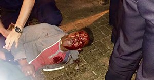 UVA Student Martese Johnson, Bloodied in Violent Arrest, Suing for $3 Million