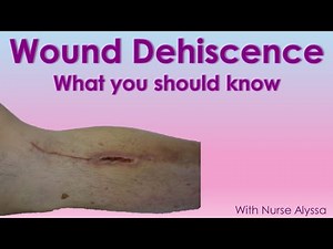Wound Dehiscence: cause, prevention & treatment