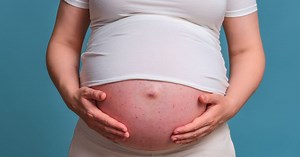 Rubéola en el embarazo: riesgos y cómo afecta a la gestación