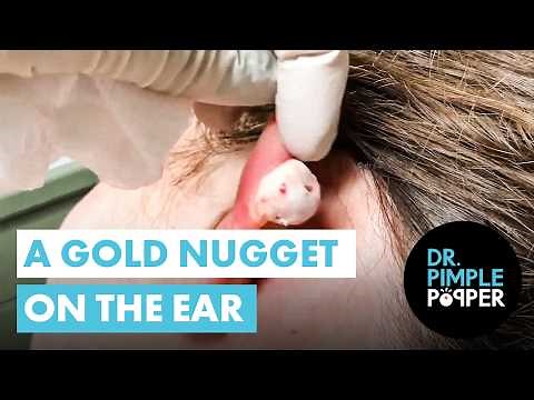 Buried Treasure? Nope—Just a Pop-Perfect Ear Nugget!