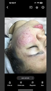 20 reactions | KingSpa Beauty&Clinic on Reels | Facebook