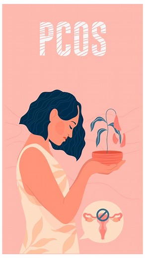 Your Baby’s here, but PCOS doesn't have to take away your new-mommy spotlight from you! Learn how to manage PCOS post-pregnancy while fully embracing the beauty of Motherhood. Breastfeeding, Careful Planning and Proper and Regular Visits to your Obstetrician, and Lactation specialist are the keys to managing your PCOS after delivery. Moreover, your lactation specialist will advise you about proper latch position & Lactation support and how their management is a must to reduce childhood diabetes 