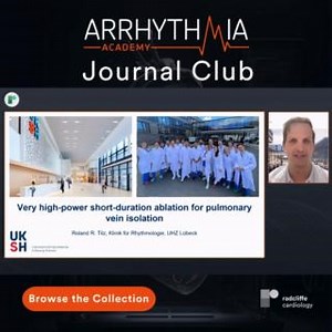 Arrhythmia Academy’s Journal Club is curated by global experts of the #EPeeps community 🫀 Browse the collection on the refreshed Arrhythmia Academy https://ow.ly/jGeq50SCoX0 🌟Watch a favourite with Profs Roland Tilz & Josef Kautzner on ⚡️High-Power Short Duration #Ablation for #PVI 📺https://ow.ly/57mv50SCoX2 Stay up to date with practical discussions on innovations, data & practice | Radcliffe Cardiology
