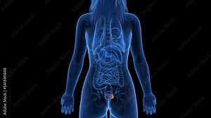 3d rendered medical animation of a bladder tumor
