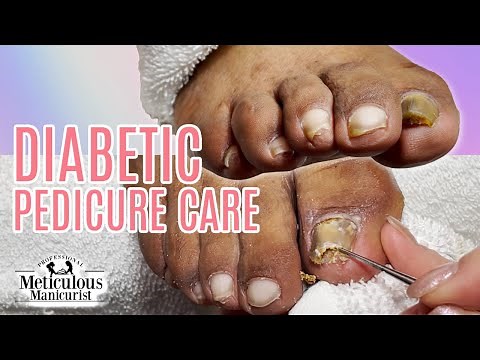 Double trouble Diabetic Care with Toenail Fungus