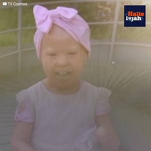 22K views · 781 reactions | A strange disease affects Maria Fe, and although her body has suffered serious amputations because of it, she carries on with a smile on her face. Her mother fears that she will lose her life since she doesn’t have the means to cope with the disease... but a miracle will appear in their lives. | Hallelujah | Facebook