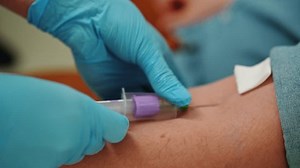 Female Lab Assistant Blue Medical Gloves Stock Footage Video (100% Royalty-free) 3473949729 | Shutterstock