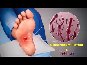 why should take TT(Tetanus Toxoid) injection? Clostridium Tetani and Tetanus