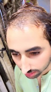 34K views · 539 reactions | Whtsapp no:+923001618816 #usa #explorepage #likeforlikes #uk #italy #spain #love #selfcare #haircaretips #organic #hairfashhairbrained #blondehair #hairdressersofinstagram #hairdressingscissors #wella #hairshows #hairinspo #hairseminars #hairmodel #creativecut #hairnerd #barber #scissorovercomb #hairstyling #ghd #colour #hairstagram #haircraft #blonde #hairtransformation | Uk Wigcenter | Facebook