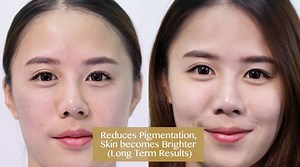 Lazy to wear makeup? But refuse to go out with a bare face? Get your instant flawless skin without makeup! éPure Nude Perfecting Essence - A multi-tasking, weightless and breathable second skin effect essence that restores skin's inner radiance & color of youth. Ultra-fine molecules infused with anti-inflammatory to soothe red and irritated skin. The melanin-inhibiting extracts that promotes whitening and even skin tone. Broad spectrum SPF30 to protect the skin from harmful UV rays. This high-po