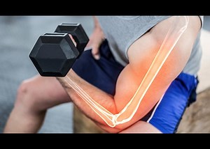 Blood Flow Restriction Exercise Offers Relief for People with Rheumatoid Arthritis
