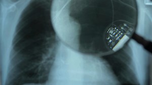 What is being shown here? | Respiratory Therapy Zone