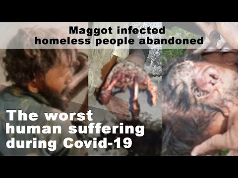 Human flesh-eating maggots infect homeless people: The worst human suffering during Covid-19