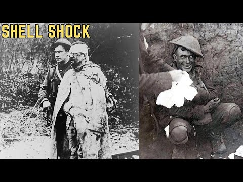 The Terror Of Shell Shock - WWI's Most BRUTAL Medical Problem?