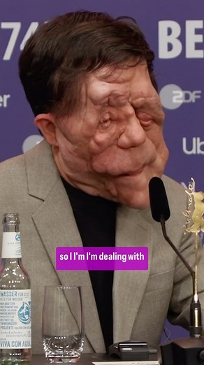 521K views · 874 reactions | At #Berlinale2024, actor #AdamPearson shares how he and #ADifferenMan star #SebastianStan found ways to connect through their experiences | The Hollywood Reporter | Facebook