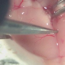 Video: Brain Membrane Fractionation: An Ex Vivo Approach to Assess Subsynaptic Protein Localization