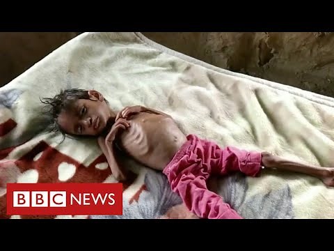 Millions of children face starvation in Yemen warns United Nations - BBC News