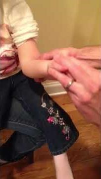 Nursemaid's Elbow Reduction Procedure